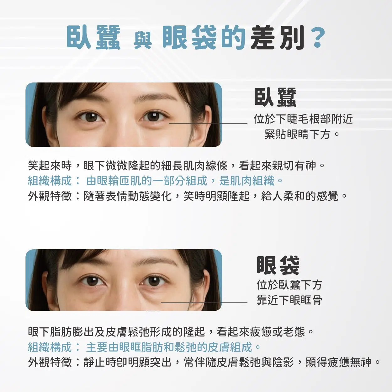 為何眼袋手術後，臥蠶更明顯？