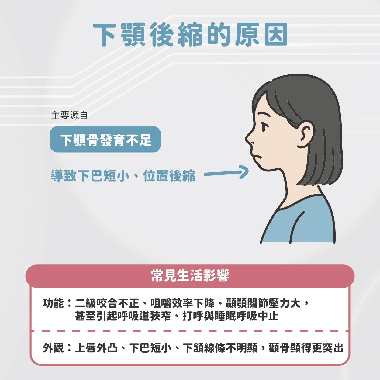 厚道 & 下顎後縮的原因與改善方法