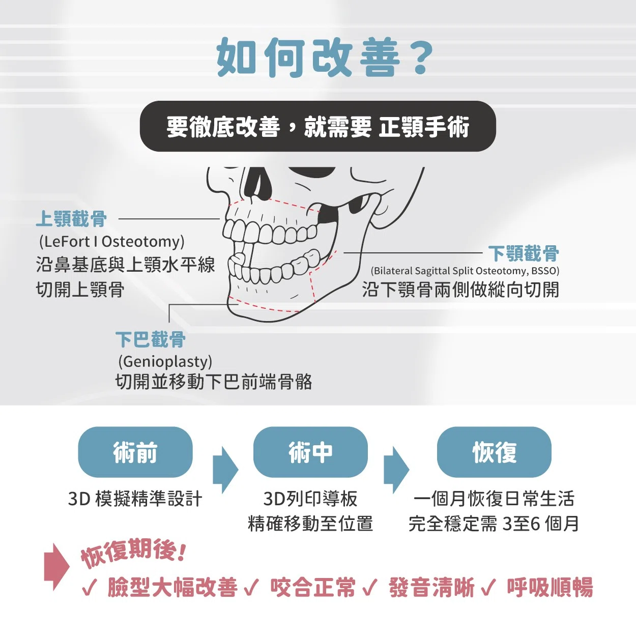 厚道 & 下顎後縮的原因與改善方法