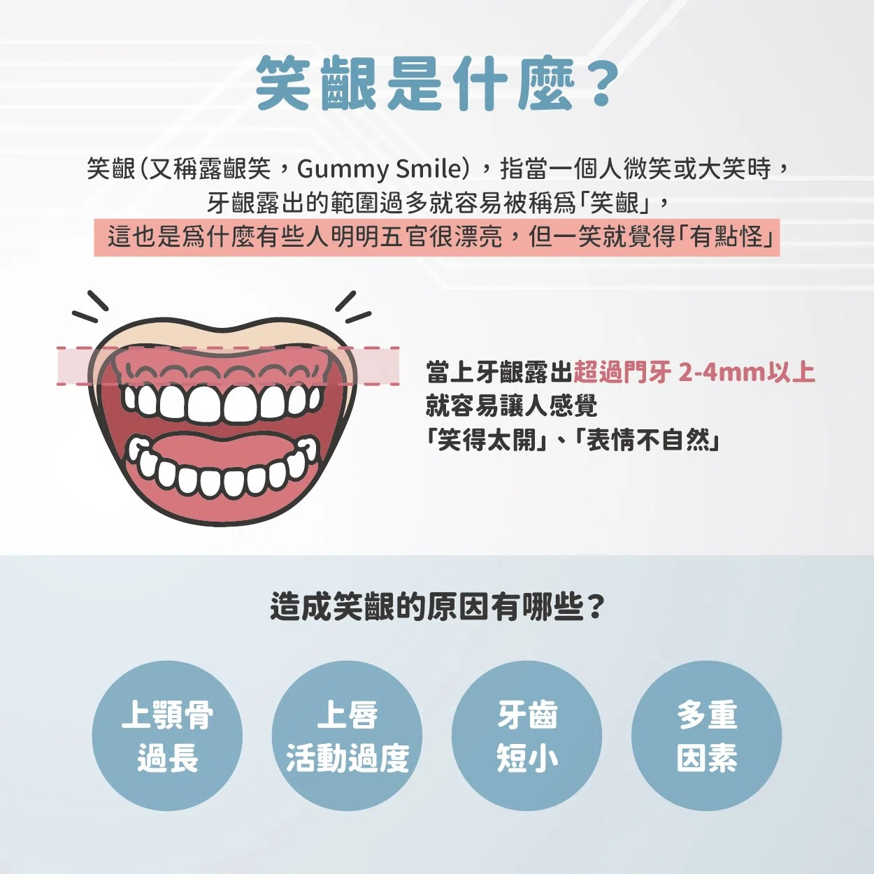 別人笑起來好甜美，我笑起來卻好可怕？！