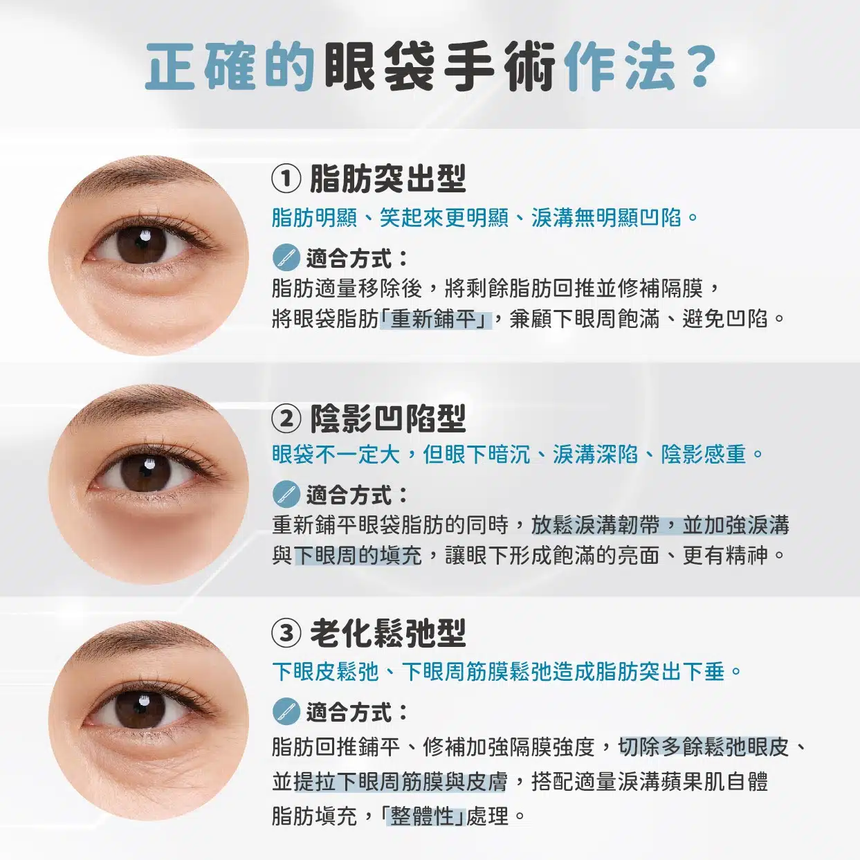 眼袋不是移除脂肪就好！解析三種眼袋類型與精準手術方案，告別顯老淚溝