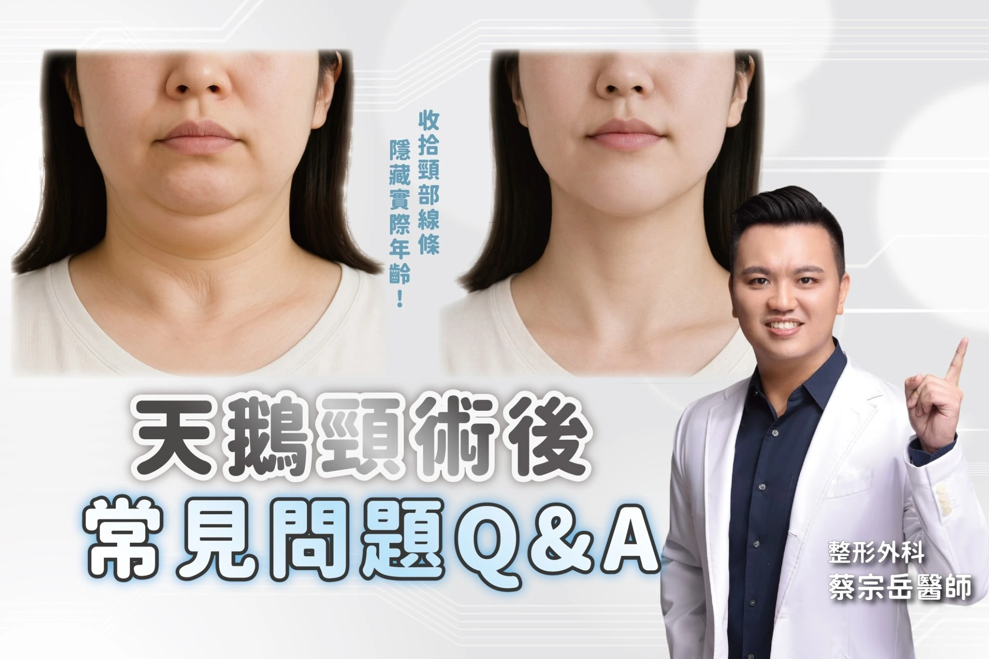 天鵝頸術後｜常見 10 大 Q&A
