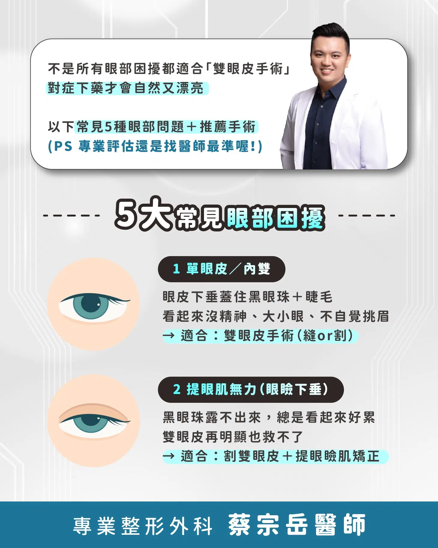 五大常見眼部困擾，一次看懂適合什麼手術！