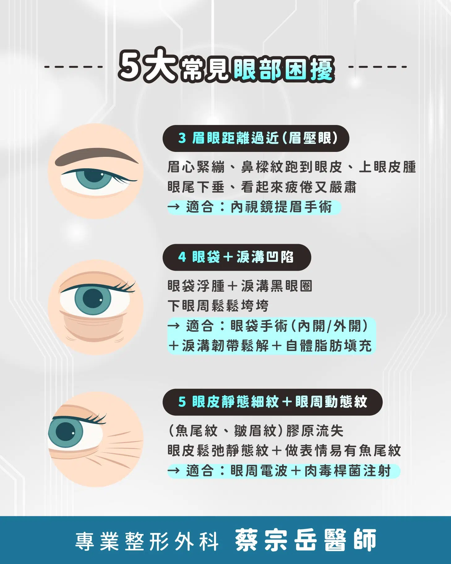 五大常見眼部困擾，一次看懂適合什麼手術！