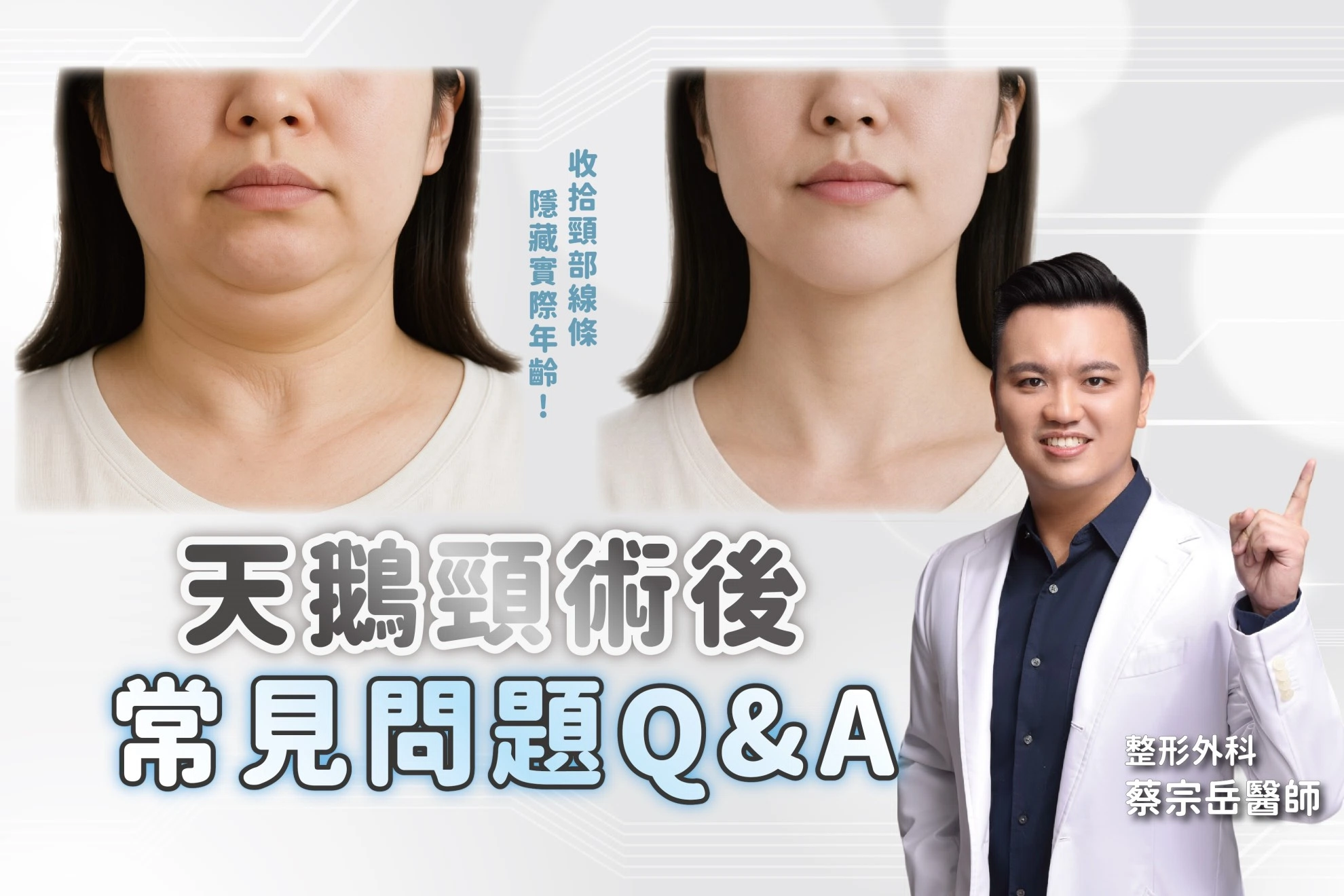 【天鵝頸術後｜常見 10 大 Q&A 🤍】讓你在決定前，更清楚整個修復過程，更安心💖