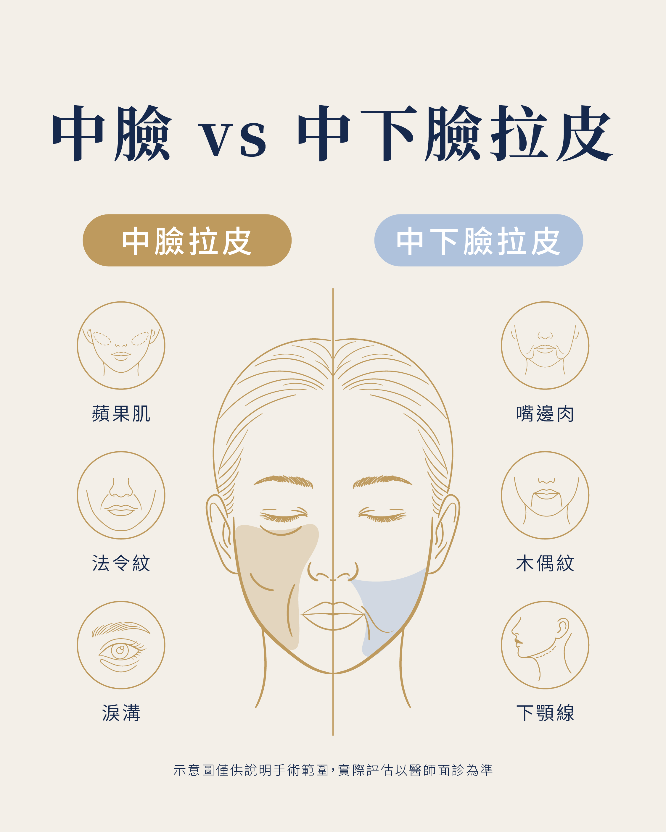 深筋膜中臉拉提｜不單純是把皮膚拉緊，而是讓臉部結構回到對的位置