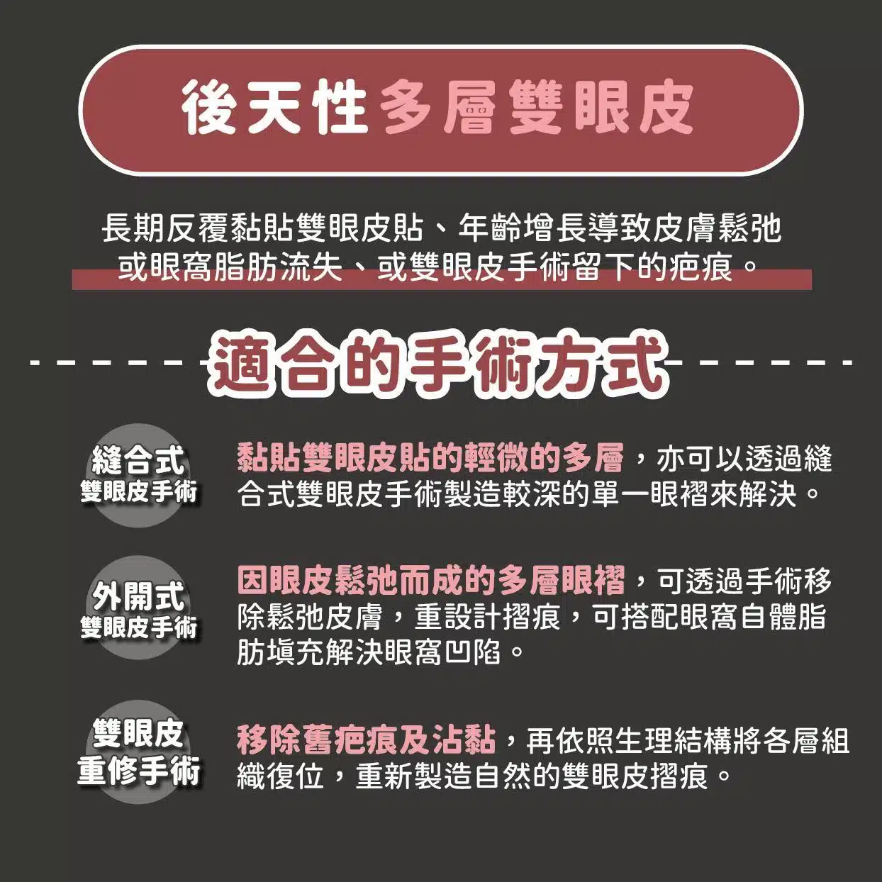 情人節可以「層層疊疊」的甜蜜,雙眼皮可別變成「千層派」! 情人節可以「層層疊疊」的甜蜜,雙眼皮可別變成「千層派」!