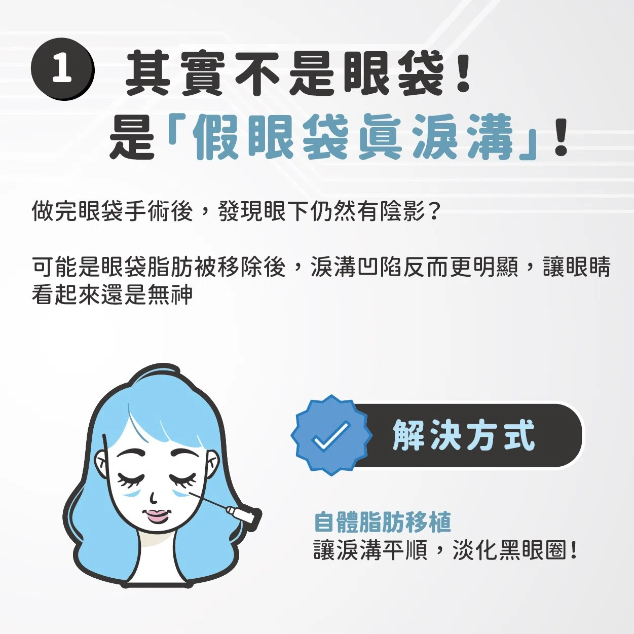 眼袋手術後又出現?別擔心!搞懂這3個關鍵原因,讓你不再為眼下問題困擾! 眼袋手術後又出現?別擔心!搞懂這3個關鍵原因,讓你不再為眼下問題困擾!